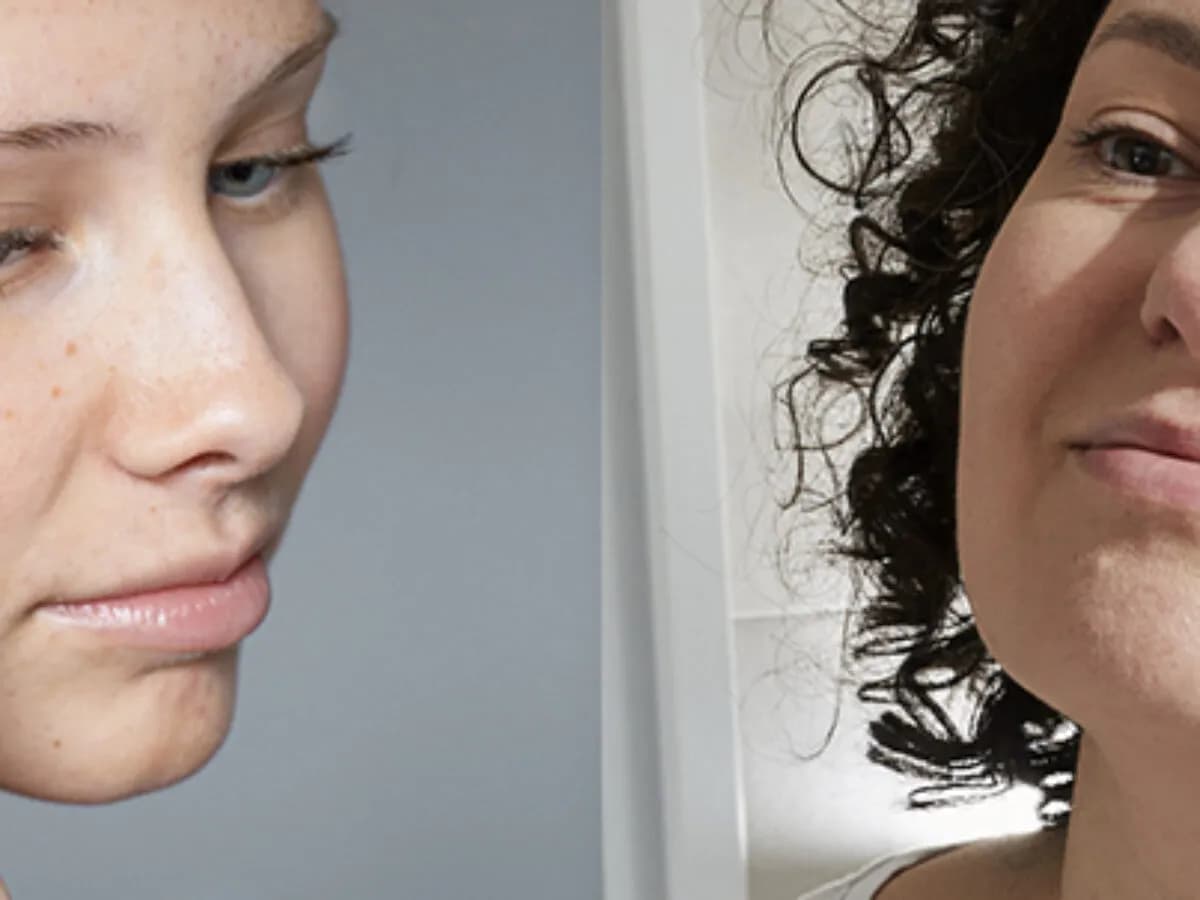 Jak wygląda cera naczynkowa i jak skutecznie o nią dbać?