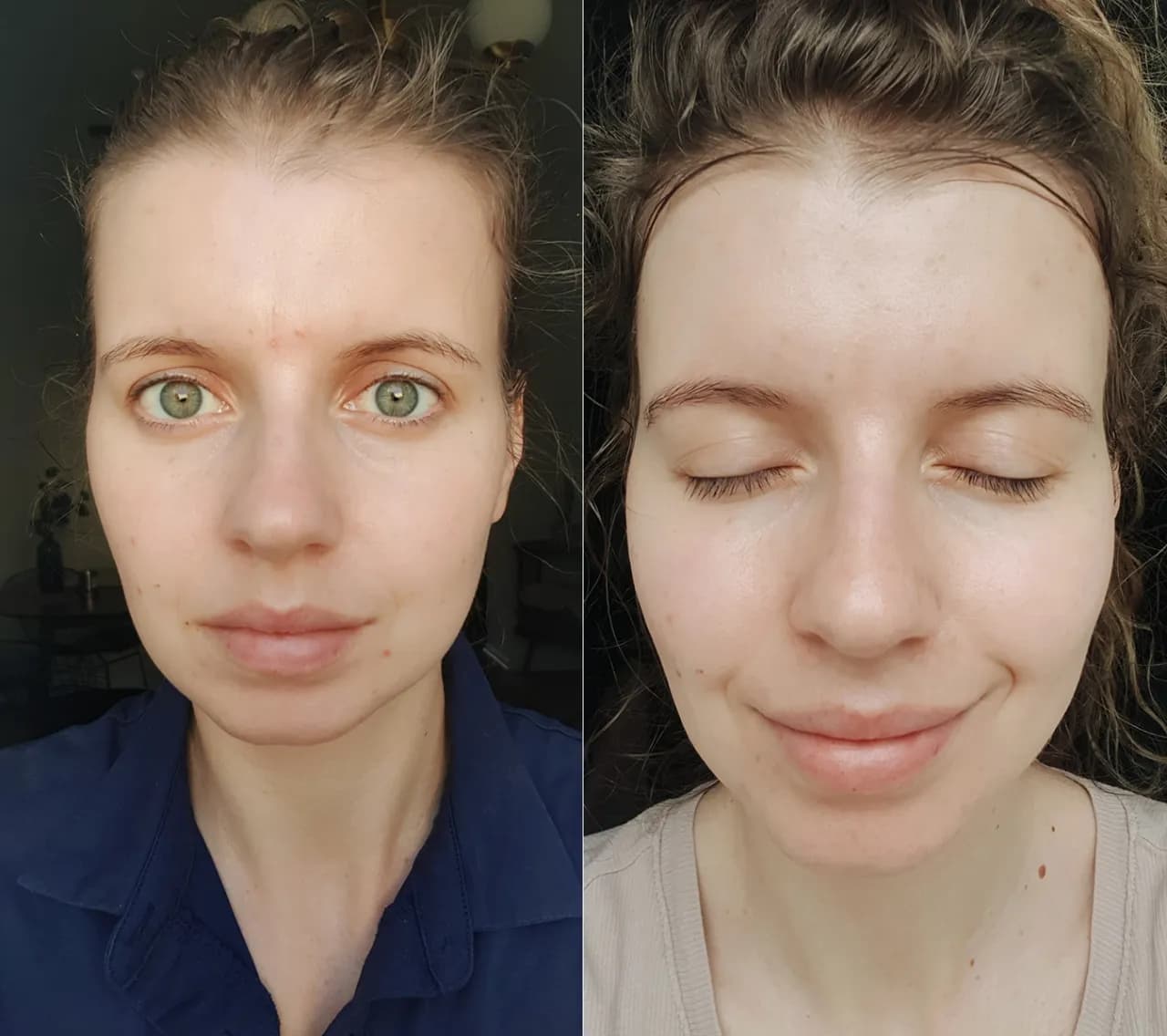 Jak mieć ładną cerę bez makijażu: skuteczne sposoby na zdrową skórę